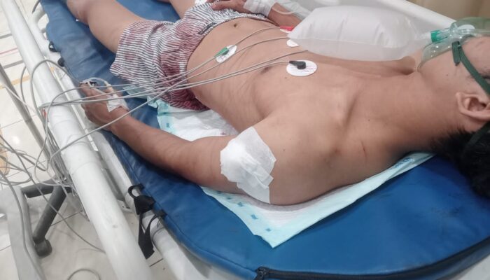Sadis! Baru Pulang Kerja, Karyawan Pabrik Ditusuk hingga Kritis oleh Kelompok Bermotor di Batam Center