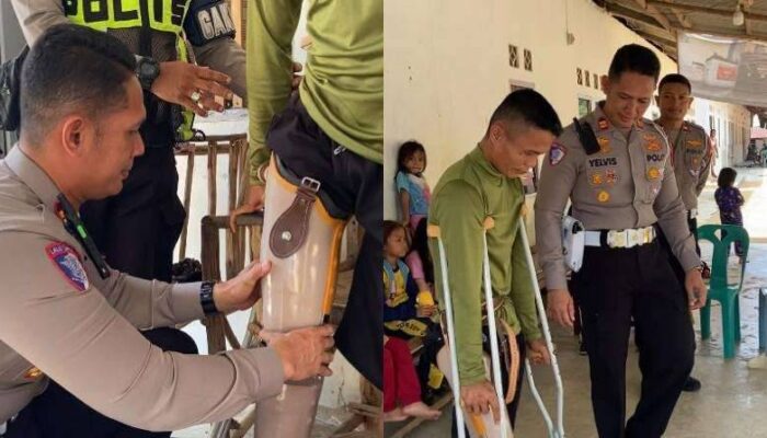 Kehilangan Kaki karena Lakalantas, Buruh Tani di Kepri Dapat Harapan Baru