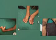 Hampir Dua Tahun Berlalu, Korban Kecelakaan Kerja di PT TSM Kampar Masih Menunggu Kepastian Hak
