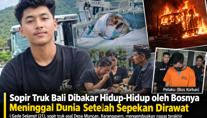 Sopir Truk Bali Dibakar Hidup-Hidup oleh Bosnya Meninggal Dunia Setelah Sepekan Dirawat